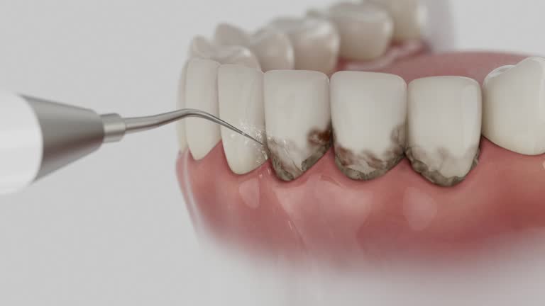 Trusted Emergency Dentist service in Hokes Bluff, AL - Dentist Open Now